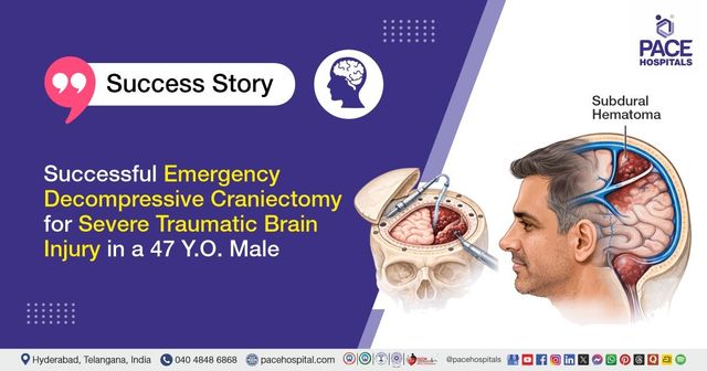 Successful Decompressive Craniectomy for Traumatic Brain Injury in a 47 Y.O. Male at PACE Hospitals
