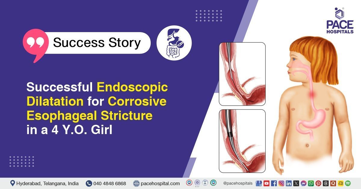 Successful endoscopic dilatation for corrosive esophageal stricture in a child at PACE Hospitals