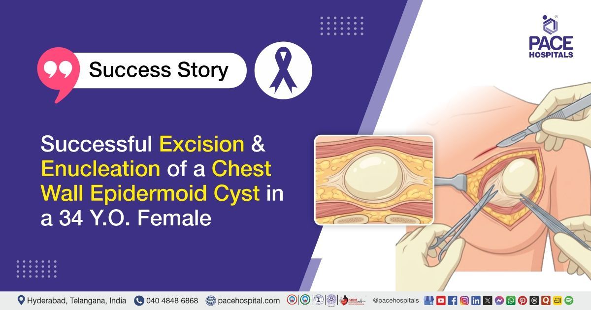 Successful Excision and Enucleation of a Chest Wall Epidermoid Cyst at PACE Hospitals