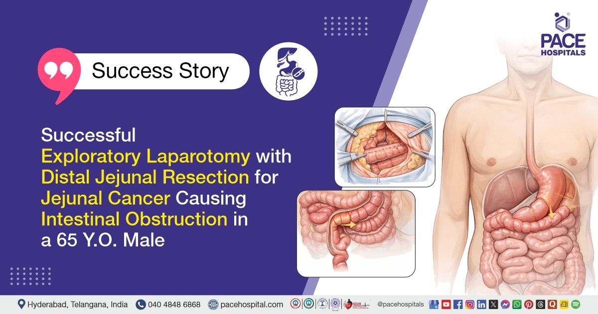 Successful Jejunal cancer surgery for intestinal obstruction in a 65 Y.O. Male at PACE Hospitals