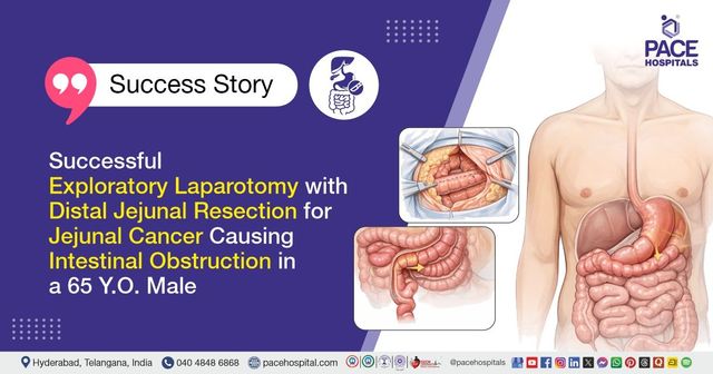 Successful Jejunal cancer surgery for intestinal obstruction in a 65 Y.O. Male at PACE Hospitals