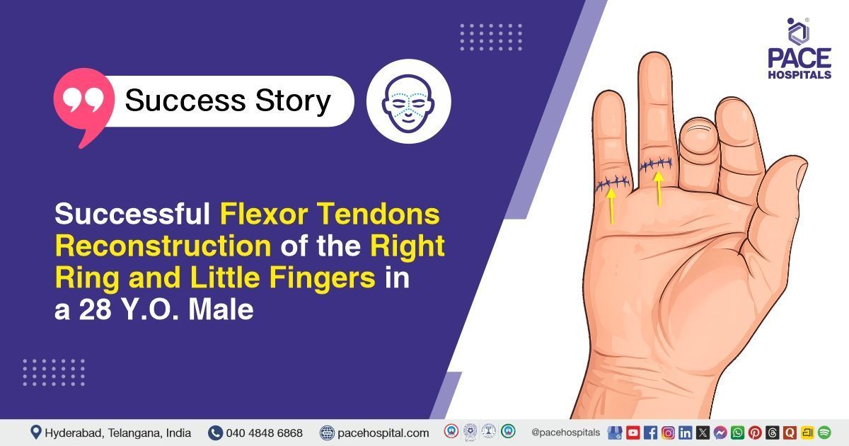 Successful flexor tendon reconstruction of right hand fingers at PACE Hospitals