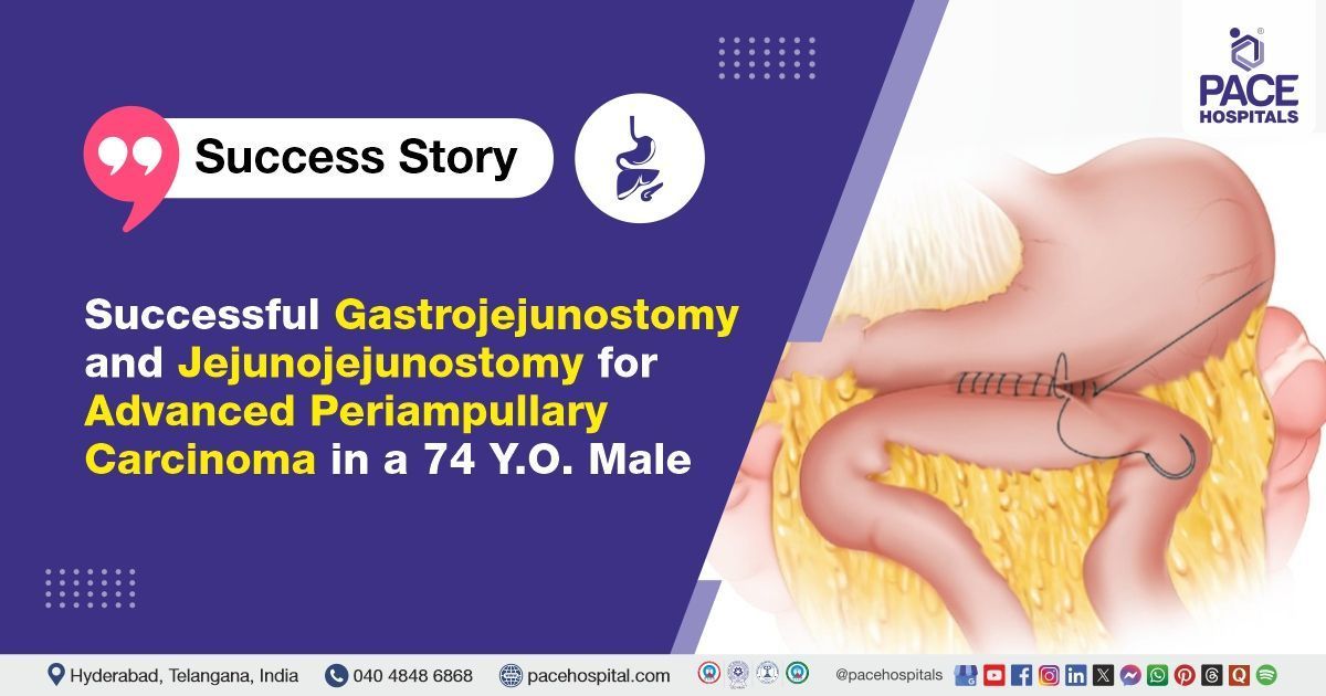 Successful gastrojejunostomy & jejunojejunostomy done for periampullary carcinoma at PACE Hospitals
