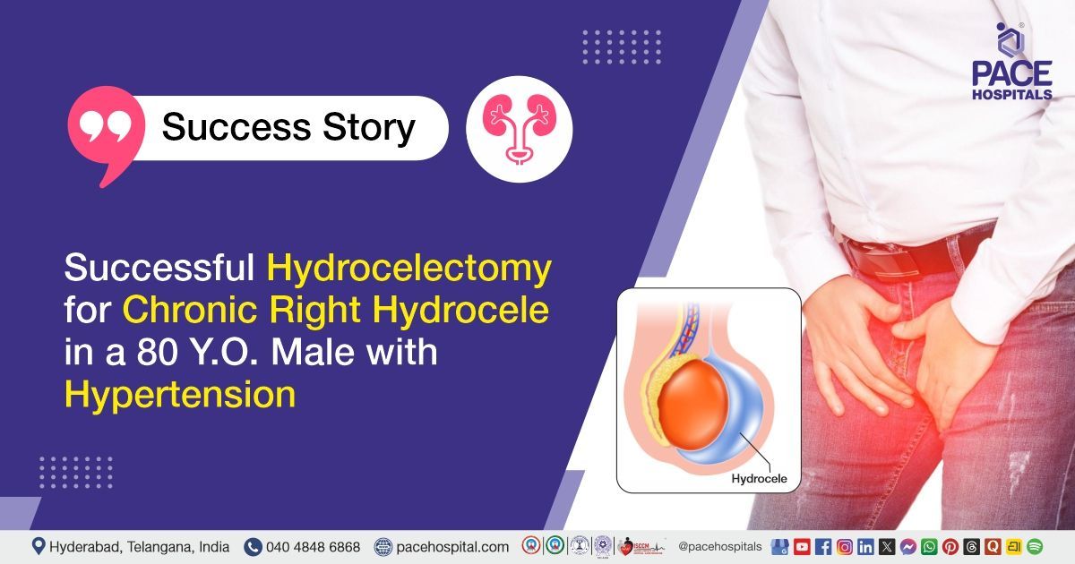 Successful Hydrocelectomy for Chronic Right Hydrocele Treatment in Hyderabad at PACE Hospitals
