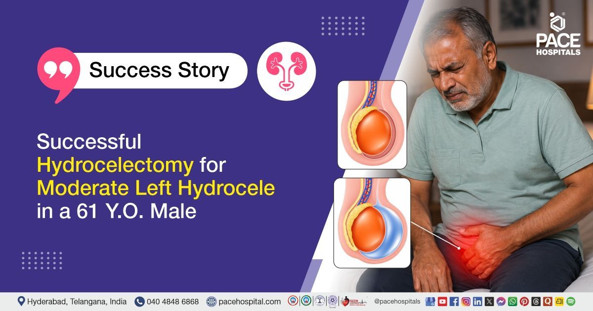 Successful Hydrocelectomy Surgery for Hydrocele Treatment at PACE Hospitals