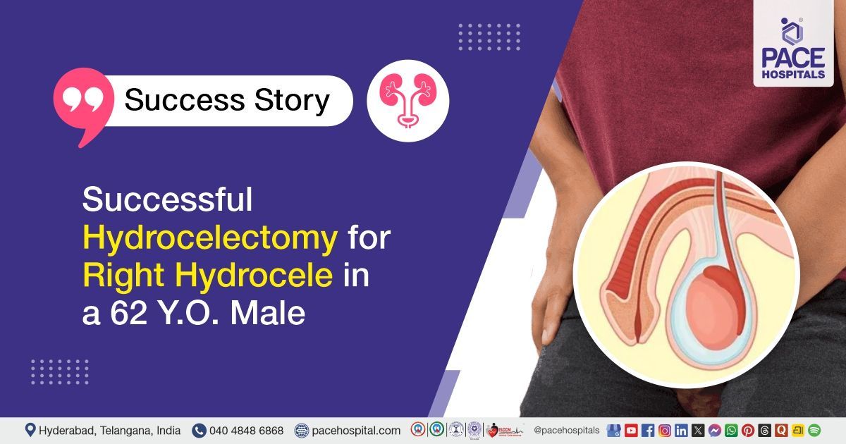 Successful Hydrocelectomy for Right Hydrocele in a 62 Y.O. Male at PACE Hospitals