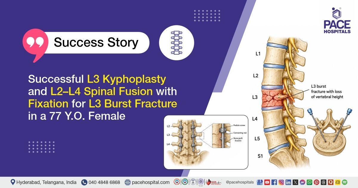 Successful Kyphoplasty and Spinal Fusion for L3 Burst Fracture treatment at PACE Hospitals