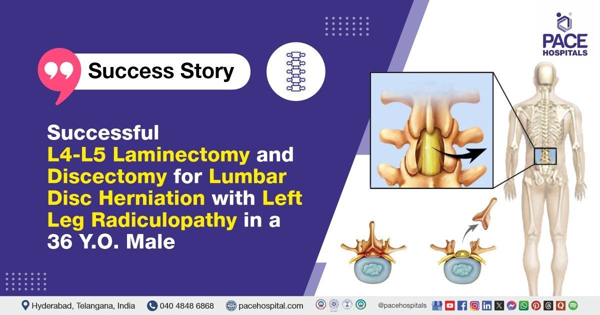 Successful laminectomy & discectomy for lumbar disc herniation & radiculopathy at PACE Hospitals