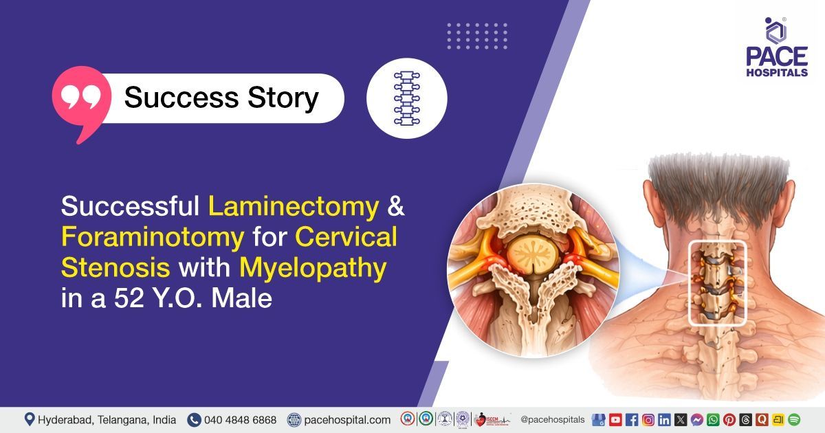 Successful Laminectomy and Foraminotomy for cervical stenosis treatment at PACE Hospitals