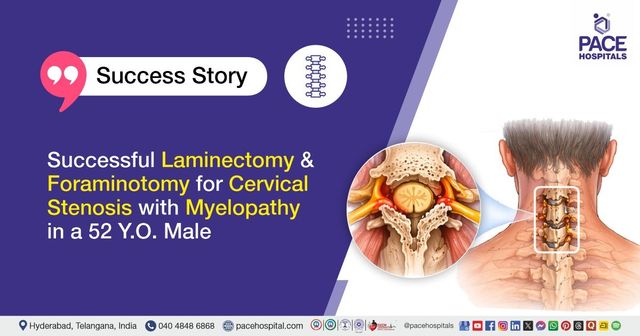 Successful Laminectomy and Foraminotomy for cervical stenosis treatment at PACE Hospitals