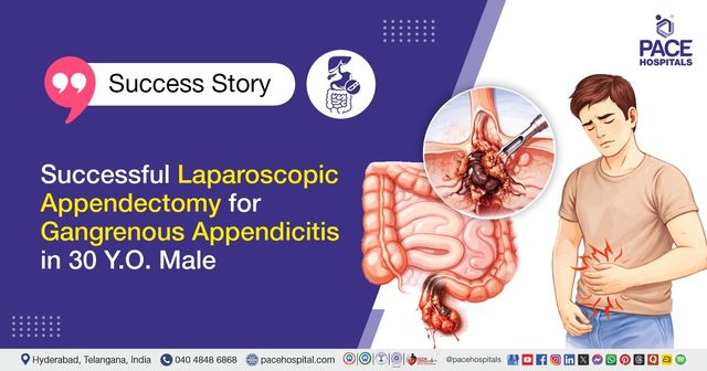 Successful Laparoscopic Appendectomy for Acute Appendicitis in 30 Y.O. Male at PACE Hospitals