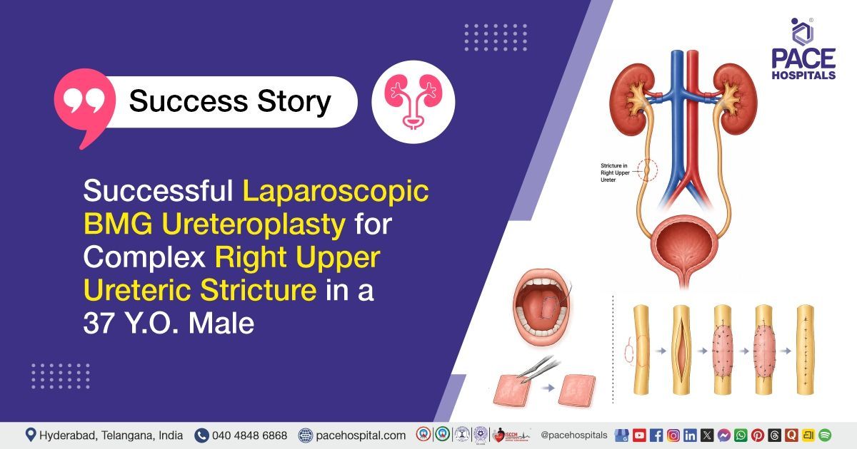 Successful Laparoscopic BMG Ureteroplasty for Complex Upper Ureteric Stricture at PACE Hospitals