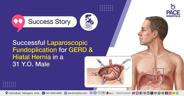Successful Laparoscopic Fundoplication for GERD and Hiatal Hernia at PACE Hospitals
