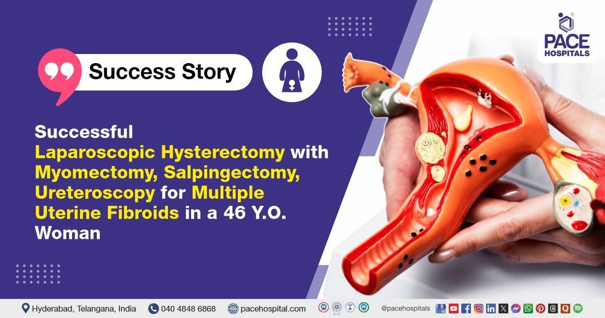 Successful laparoscopic hysterectomy with myomectomy done for uterine fibroids at PACE Hospitals