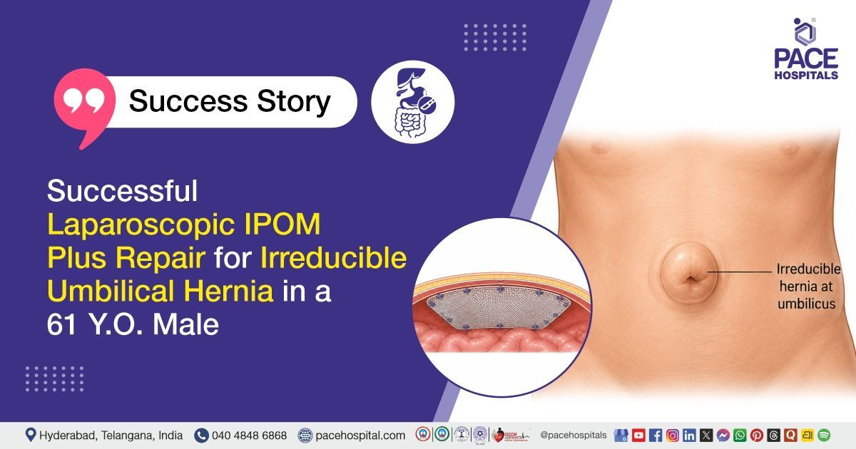 Successful laparoscopic IPOM Plus repair of irreducible umbilical hernia treatment at PACE Hospitals