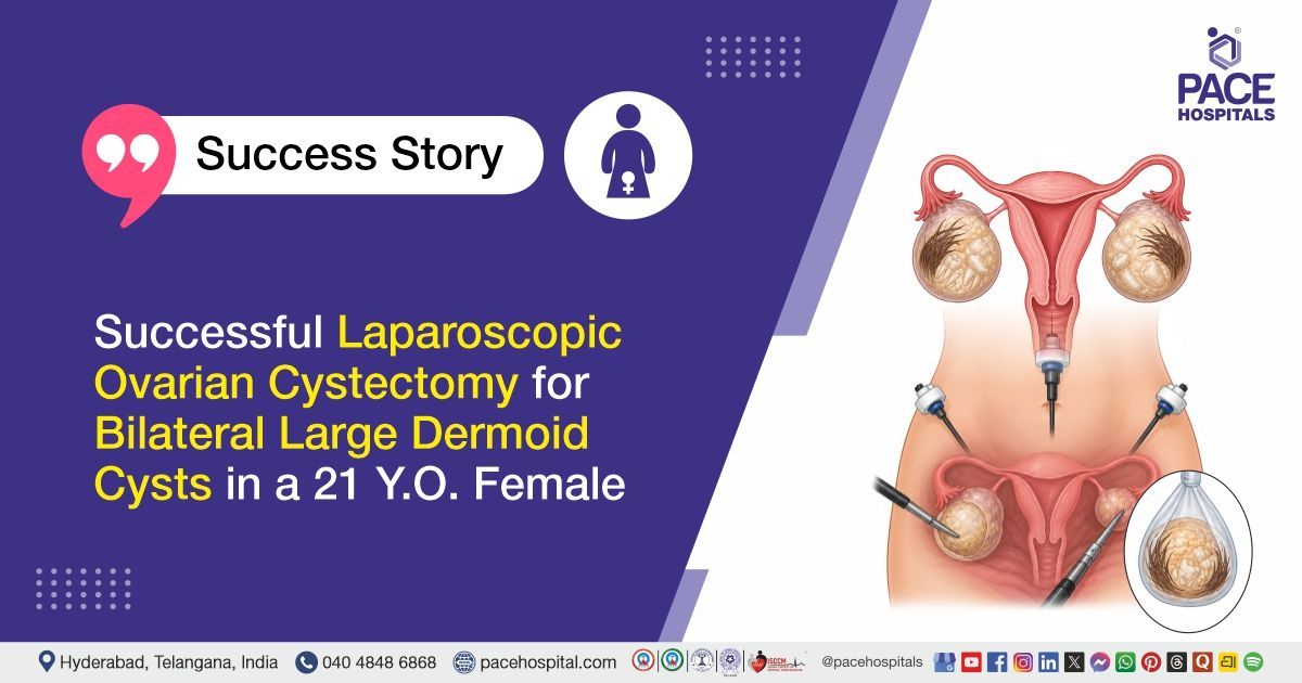 Successful Laparoscopic Ovarian Cystectomy for Bilateral Dermoid Cysts at PACE Hospitals