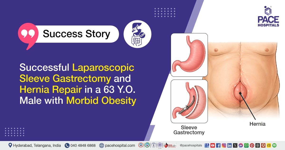 Successful Laparoscopic Sleeve Gastrectomy for Morbid Obesity treatment at PACE Hospitals