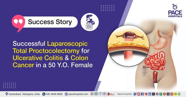 Successful Laparoscopic Proctocolectomy for Ulcerative Colitis and Colon Cancer at PACE Hospitals