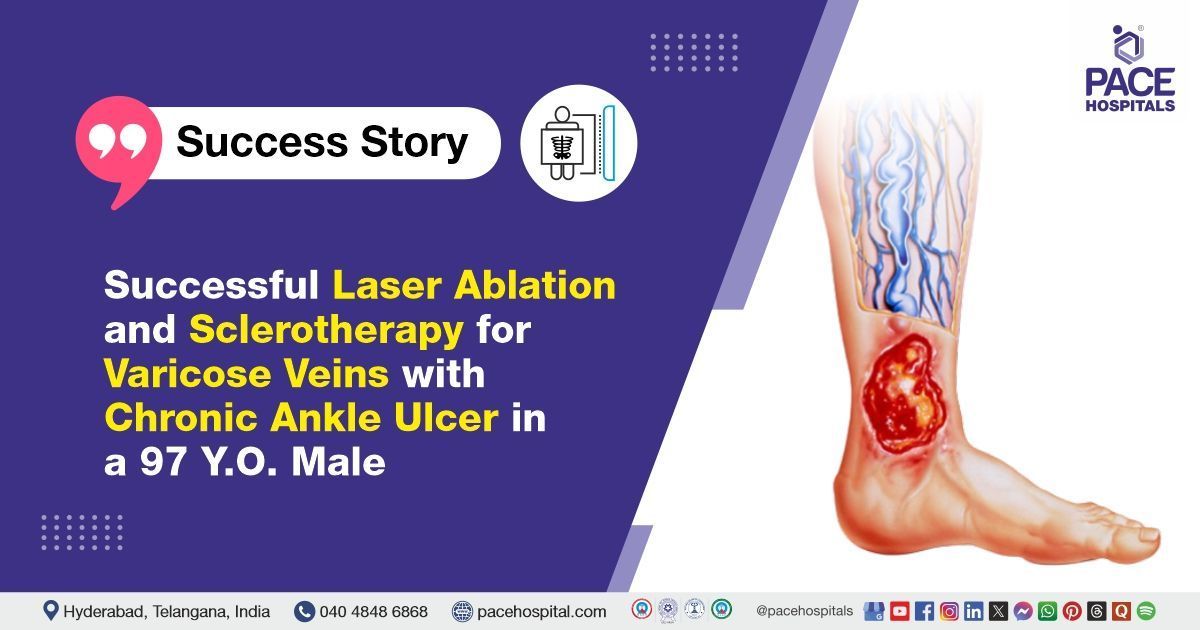 Successful laser ablation & sclerotherapy for varicose veins & ankle ulcer at PACE Hospitals