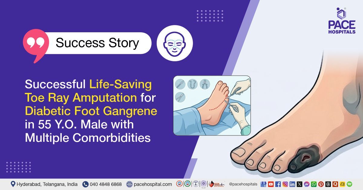 Successful toe ray amputation for diabetic foot gangrene in a 55-year-old male at PACE Hospitals