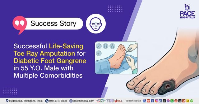 Successful toe ray amputation for diabetic foot gangrene in a 55-year-old male at PACE Hospitals