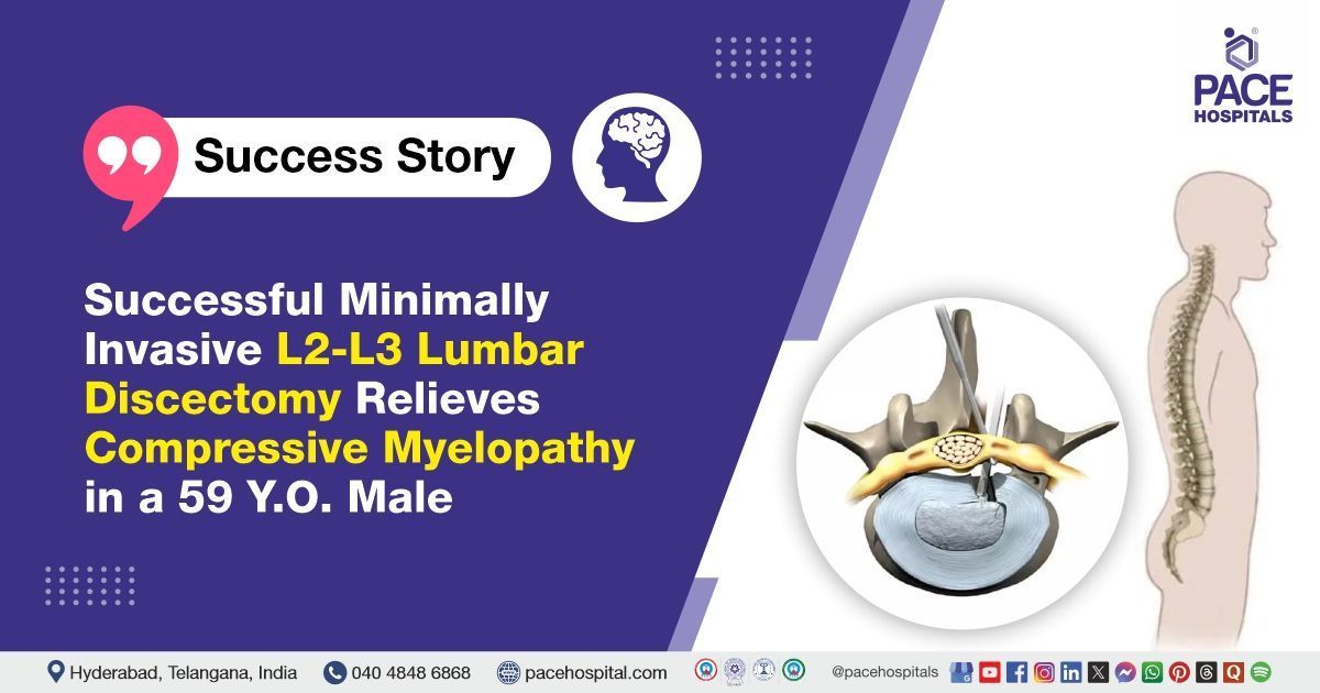 Successful minimally invasive L2-L3 lumbar discectomy for compressive myelopathy at PACE Hospitals