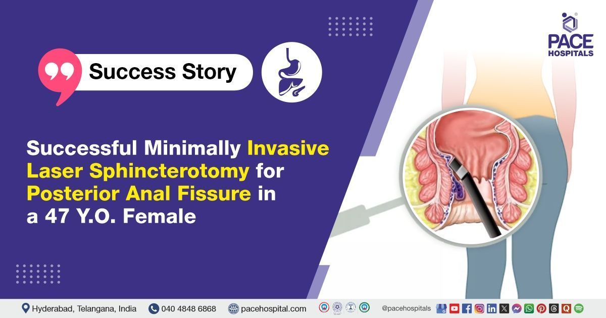 Successful Posterior Anal Fissure treatment with Laser Sphincterotomy at PACE Hospitals