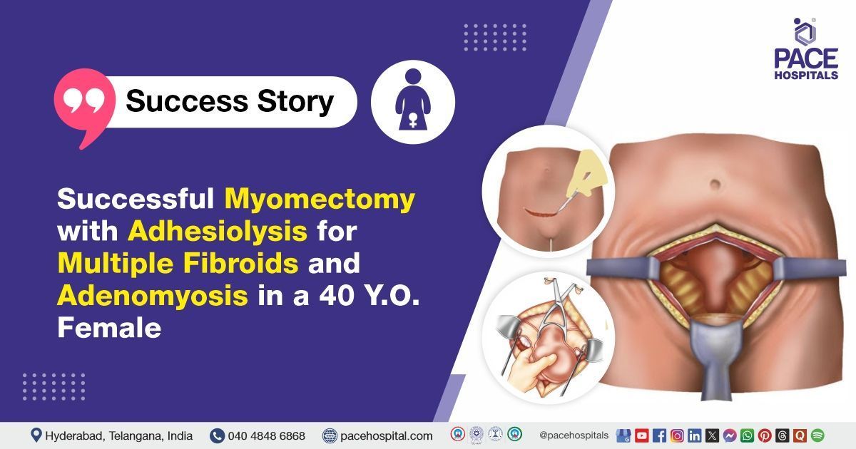 Successful myomectomy, adhesiolysis & cystoscopy for fibroids and adenomyosis at PACE Hospitals