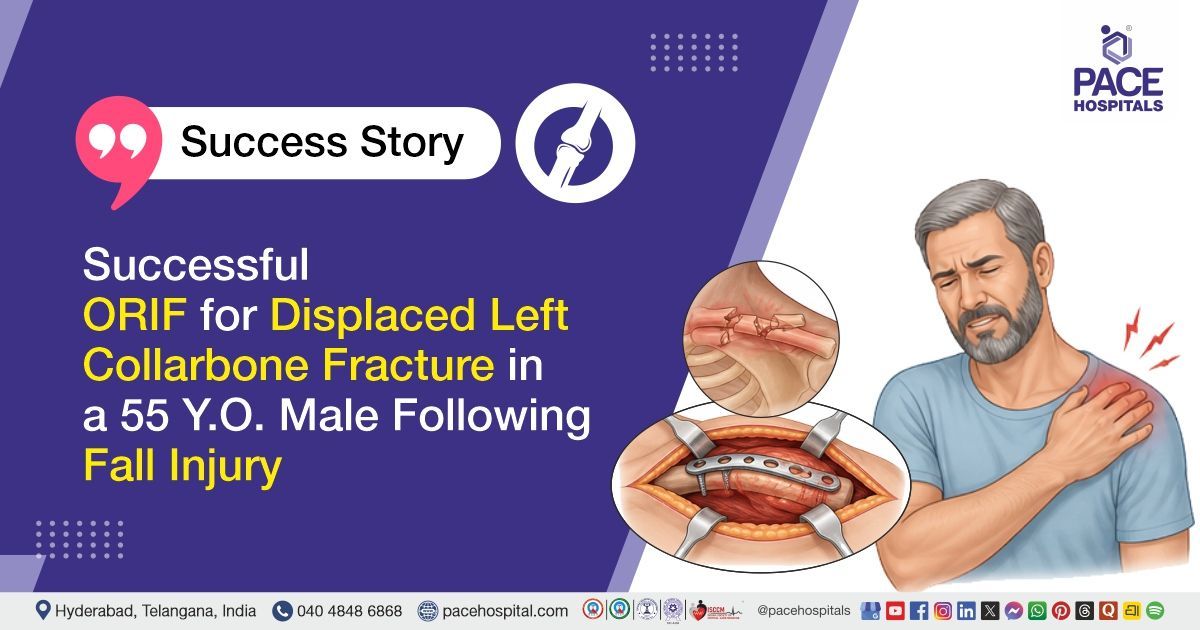 Successful ORIF surgery for a displaced left clavicle (collarbone) fracture at PACE Hospitals
