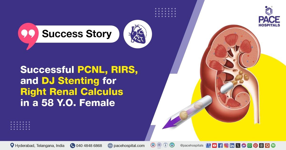 Successful PCNL, RIRS and DJ stenting performed for right kidney stone treatment at PACE Hospitals.