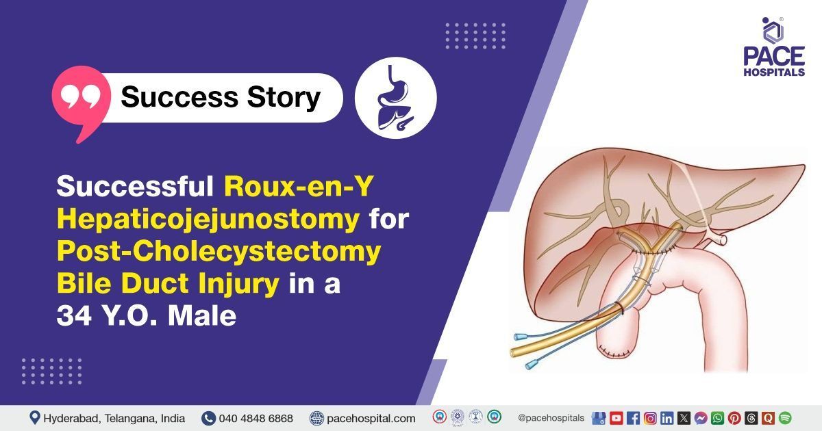 Successful Roux-en-Y hepaticojejunostomy done for benign biliary stricture at PACE Hospitals