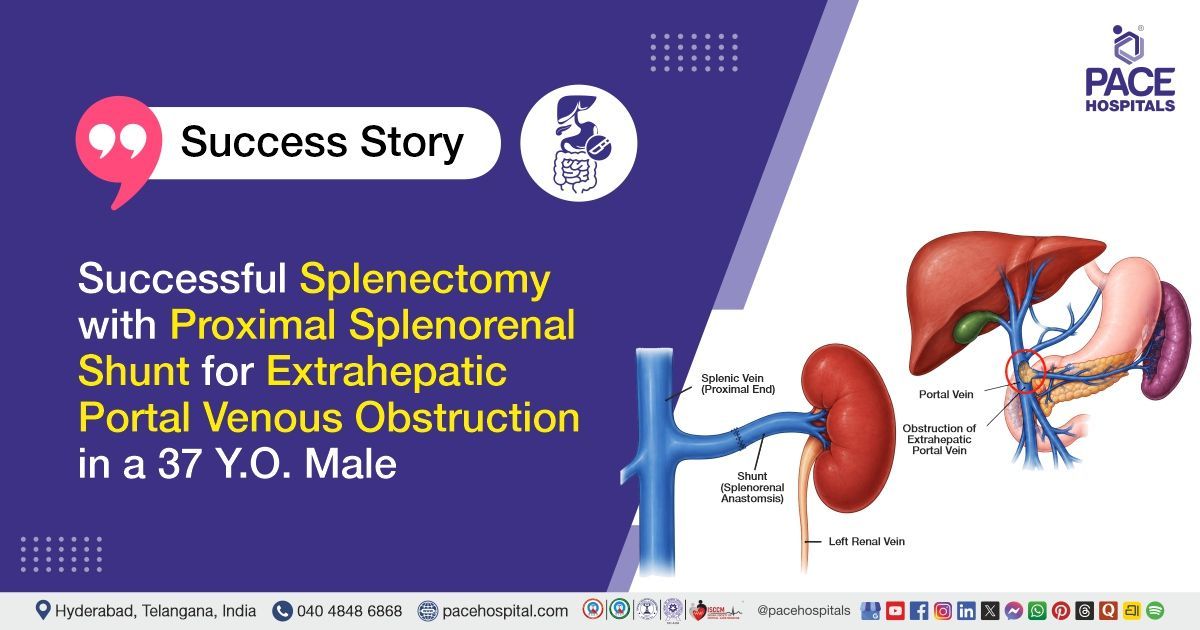 Successful Splenectomy with Proximal Splenorenal Shunt for EHPVO treatment at PACE Hospitals