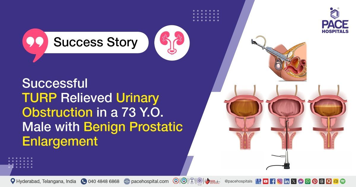 Successful TURP for Benign Prostatic Enlargement Treatment at PACE Hospitals