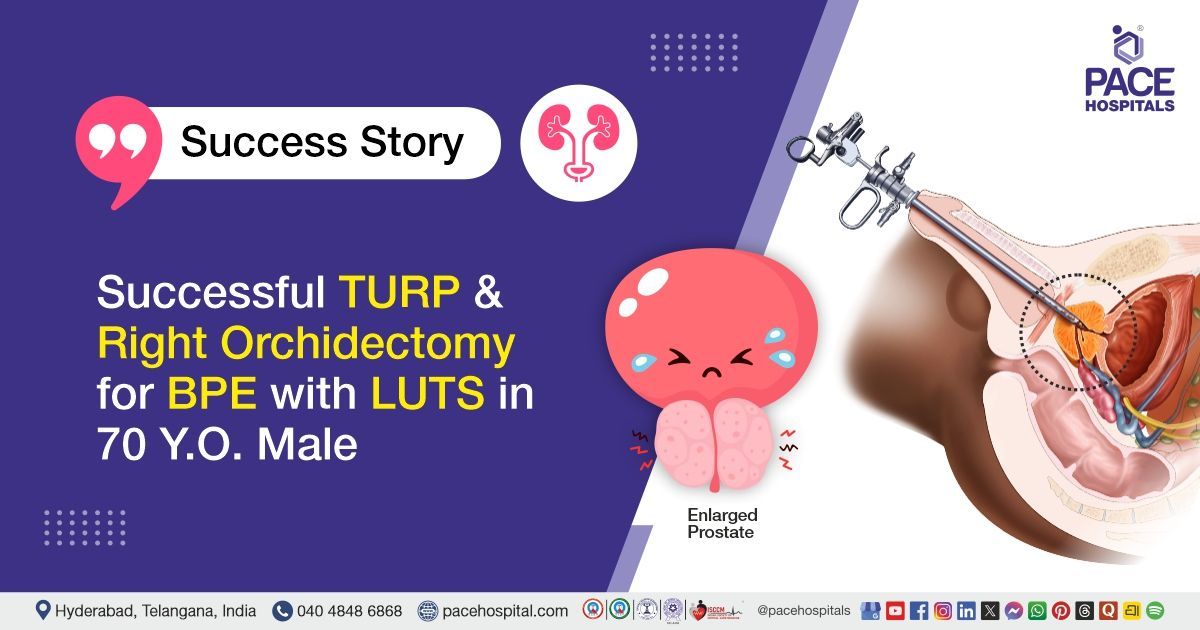 Successful TURP and Right Orchidectomy for BPE with LUTS in 70 Y.O. Male at PACE Hospitals