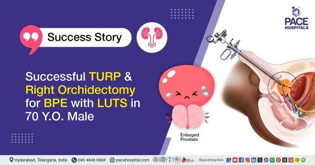 Successful TURP and Right Orchidectomy for BPE with LUTS in 70 Y.O. Male at PACE Hospitals