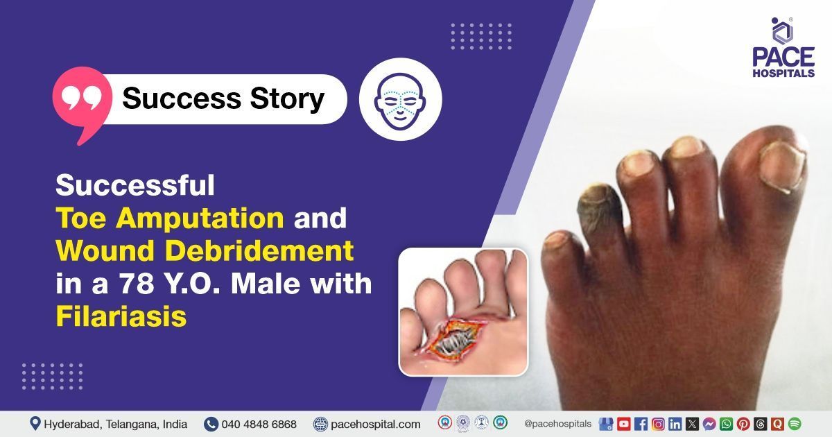 Successful toe amputation and wound debridement for filariasis at PACE Hospitals