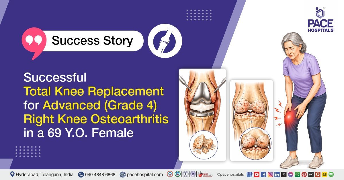 Successful total knee replacement for Grade 4 Knee osteoarthritis treatment at PACE Hospitals