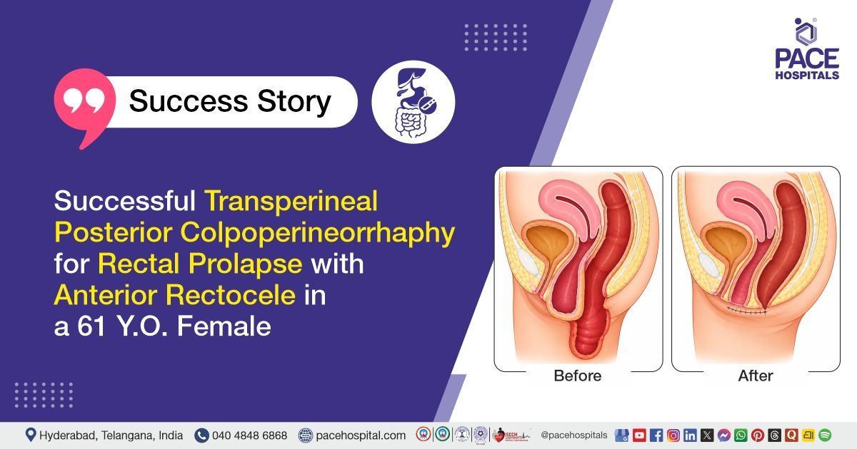 Successful Colpoperineorrhaphy for Rectal Prolapse with Anterior Rectocele at PACE Hospitals