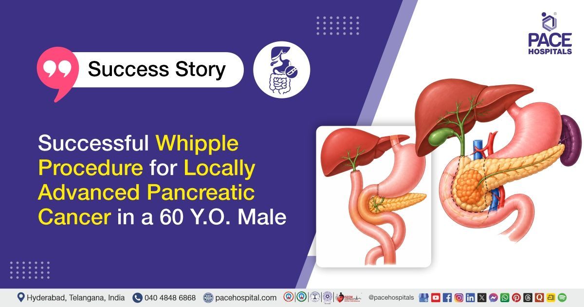 Successful Whipple procedure with vascular reconstruction for pancreatic cancer at PACE Hospitals