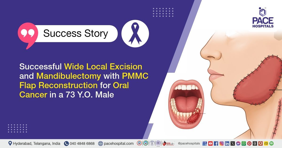 Successful Mandibulectomy with PMMC Flap Reconstruction for Oral Cancer treatment at PACE Hospitals
