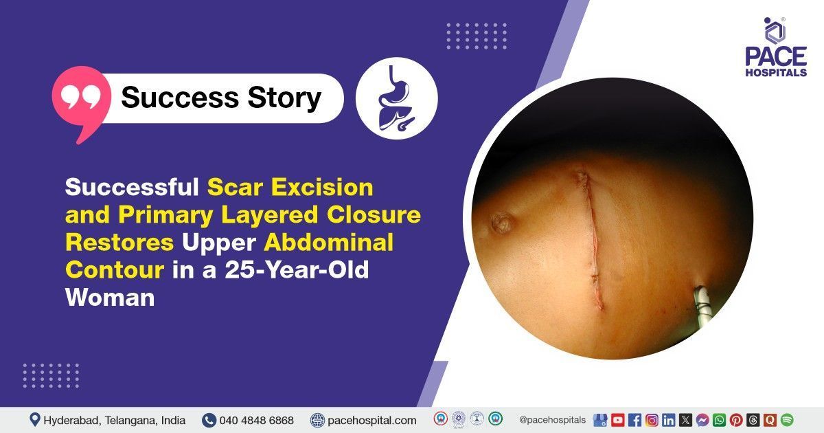 Successful Scar Excision and Layered Closure done for Abdominal Contour deformities at PACE Hospital