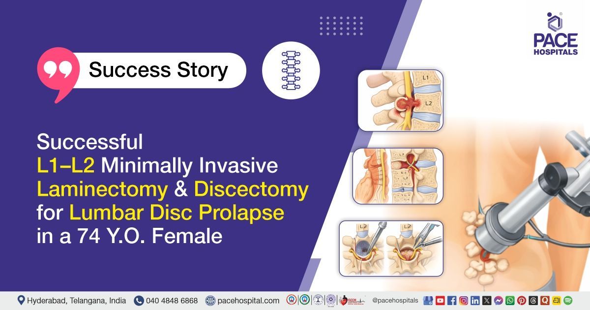 Successful minimally invasive laminectomy and discectomy for lumbar disc prolapse at PACE Hospitals