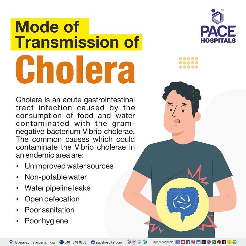 What is the mode of transmission of cholera | mode of infection of cholera |  how | How cholera transmits | How cholera spreads | A visual depicting different modes of transmission of cholera disease and a person affected by the transmission of cholera.
