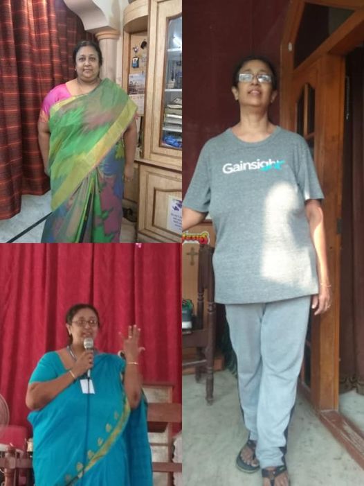 Mrs. SF aged 41 sufferers from morbid obesity weight 170 kg BMI 62 with COPD and severe OSA