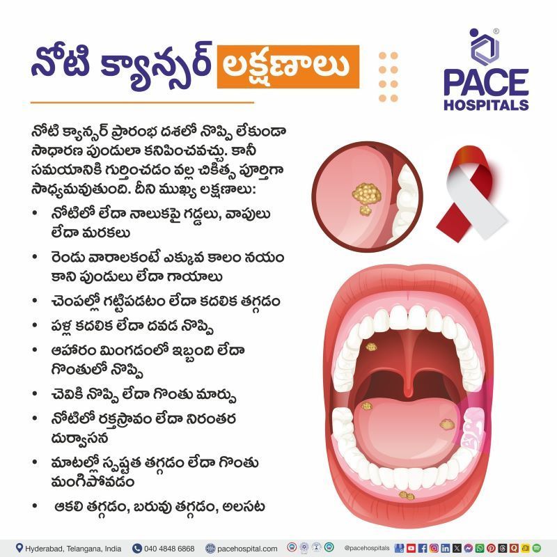 నోటి క్యాన్సర్ లక్షణాలు | Mouth Cancer Symptoms in Telugu Mouth Cancer Symptoms in Telugu | నోటి క్యాన్సర్ లక్షణాలు | Oral Cancer Symptoms in Telugu