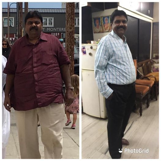 Mr. AK 50 year male 135 kg with comorbidities uncontrolled diabetes Hypertension, COPD and sleep apnea