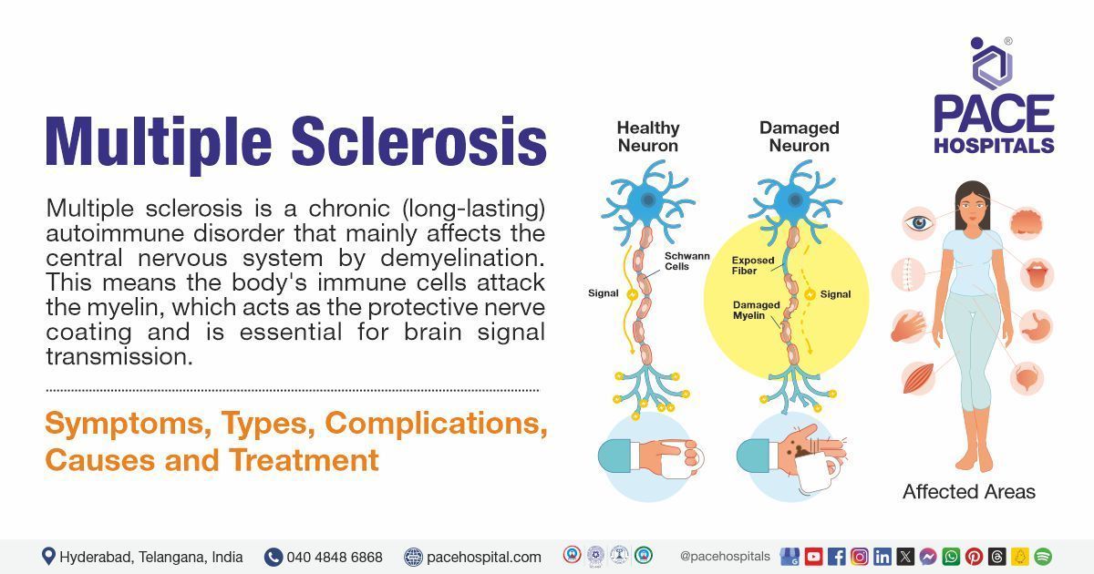 Multiple sclerosis causes and symptoms | Multiple sclerosis treatment in India | Multiple sclerosis