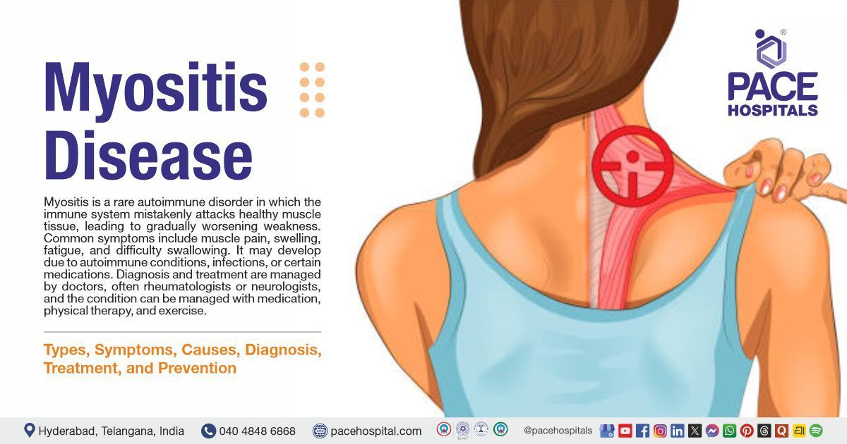 Myositis Disease- Symptoms, Causes, Types, Diagnosis & Treatment | What is Myositis