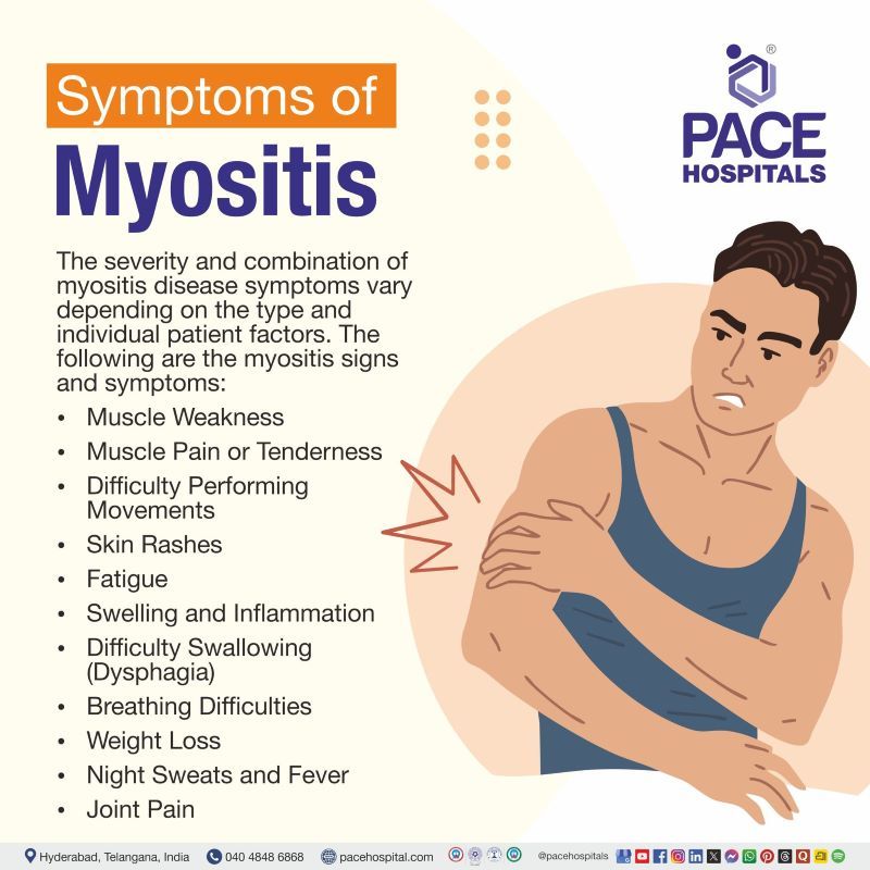 Myositis Symptoms Myositis Symptoms | What are the symptoms of myositis | Symptoms of myositis