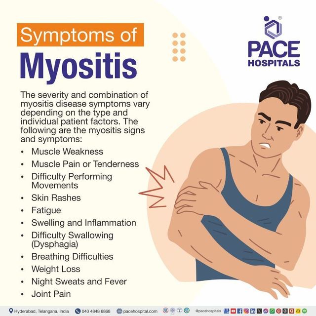 What Autoimmune Disease Causes Constant Muscle Pain Icd 10 Infoupdate